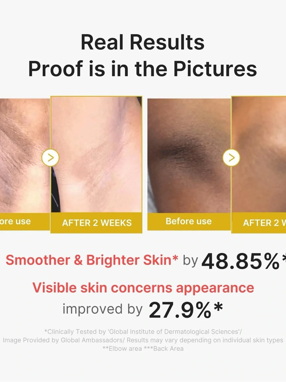 Medicube rub refine